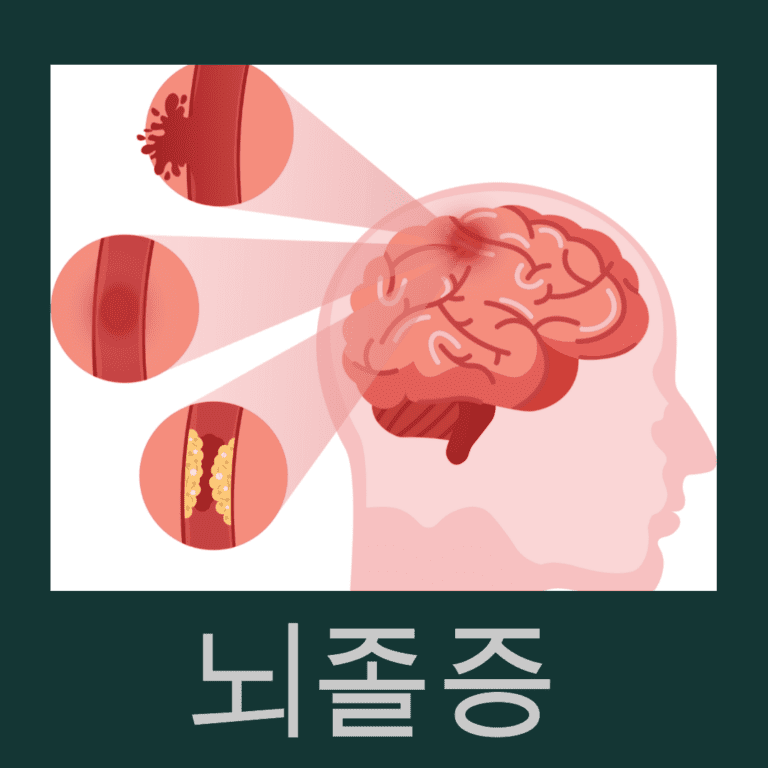 뇌졸증, 뇌경색, 뇌출혈